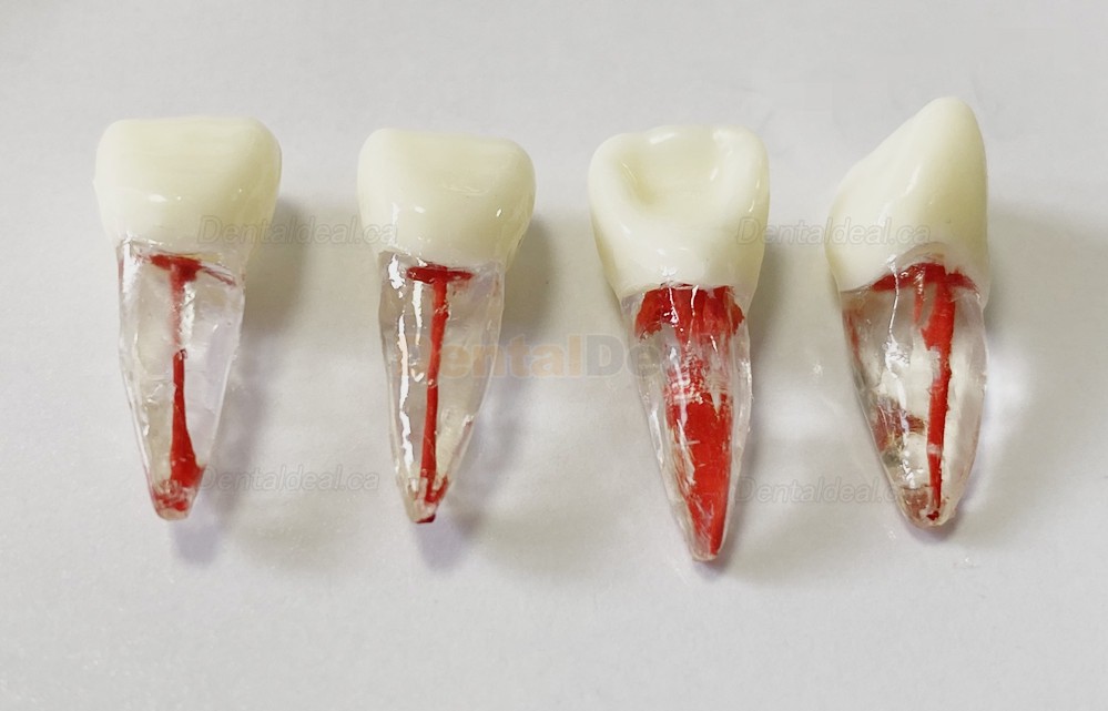 Dental Teeth Practice Model Endo File Molar Upper Lower Tooth Premolar Root 2/3-Rooted Canal